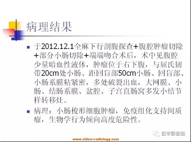 【病例】小肠胃肠道间质瘤1例CT