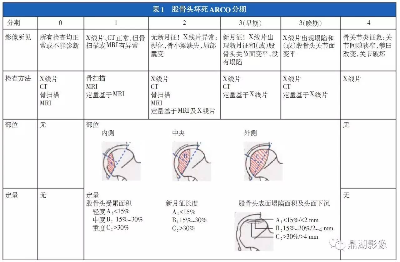 股骨头坏死中国分期 股骨头坏死中国分期