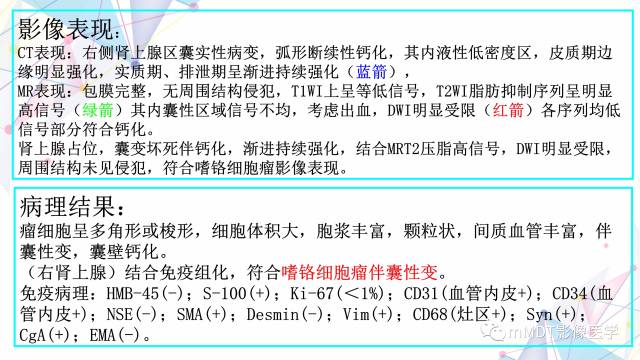 【PPT】肾上腺嗜铬细胞瘤影像诊断