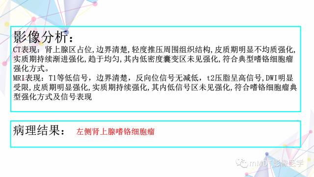 【PPT】肾上腺嗜铬细胞瘤影像诊断