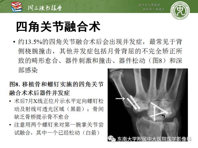 【PPT】腕关节炎术后影像评估