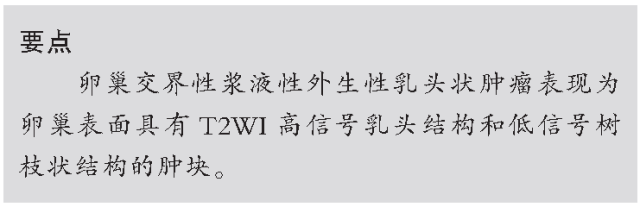 交界性和浆液性卵巢肿瘤的CT及MRI表现