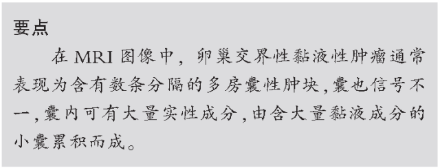 交界性和浆液性卵巢肿瘤的CT及MRI表现