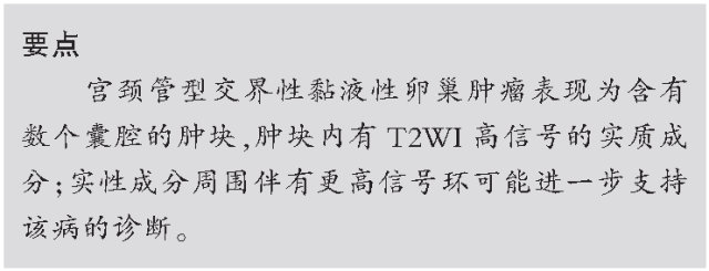 交界性和浆液性卵巢肿瘤的CT及MRI表现
