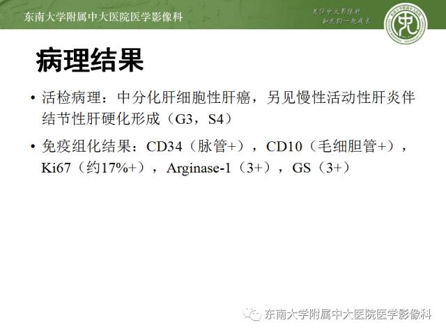 【病例】原发性肝癌1例CT及MR影像表现