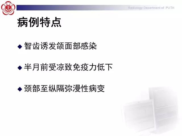 【病例】智齿诱发下行性坏死性纵隔炎1例CT