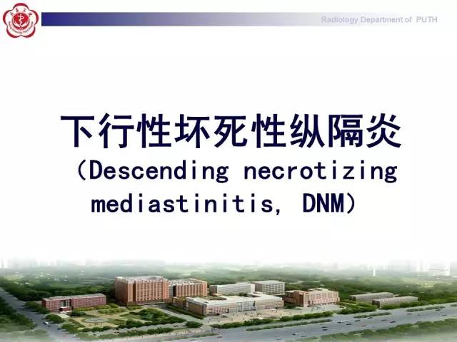【病例】智齿诱发下行性坏死性纵隔炎1例CT