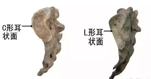 骶骨常见的解剖变异 骶骨常见的解剖变异