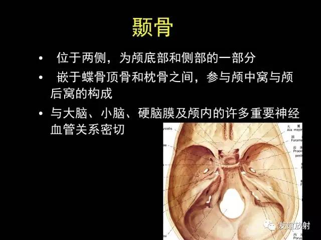 【PPT】颞骨影像解剖