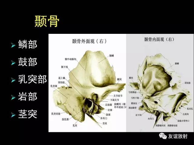 【PPT】颞骨影像解剖