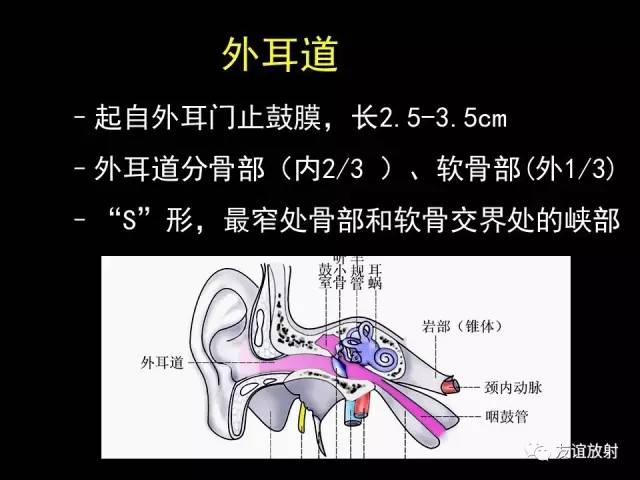 【PPT】颞骨影像解剖