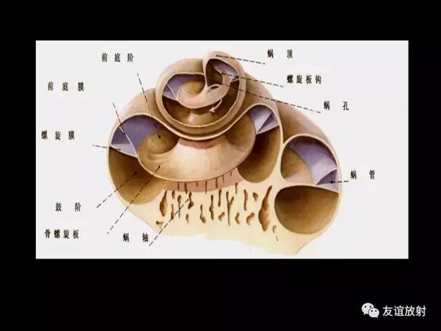 【PPT】颞骨影像解剖