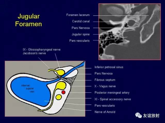 【PPT】颞骨影像解剖