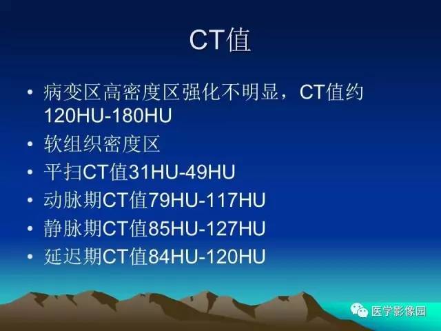 【病例】小肠间质瘤1例CT影像表现 【病例】小肠间质瘤1例CT影像表现