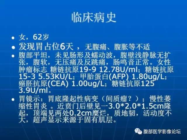 【病例】(胃体)胃肠道间质瘤1例CT影像表现
