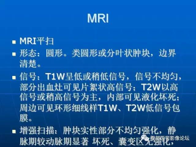 【病例】(胃体)胃肠道间质瘤1例CT影像表现