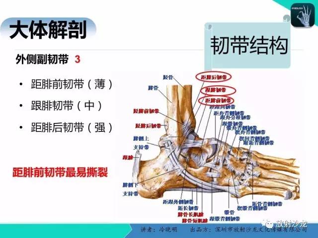 【PPT】基于损伤机制的踝关节急性损伤的影像学评估