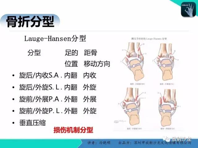 【PPT】基于损伤机制的踝关节急性损伤的影像学评估