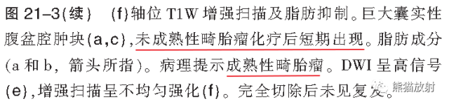 卵巢恶性生殖细胞瘤的CT和MRI表现