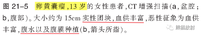 卵巢恶性生殖细胞瘤的CT和MRI表现