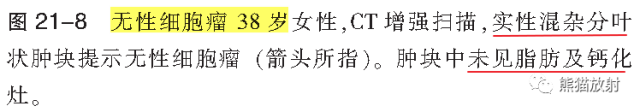 卵巢恶性生殖细胞瘤的CT和MRI表现