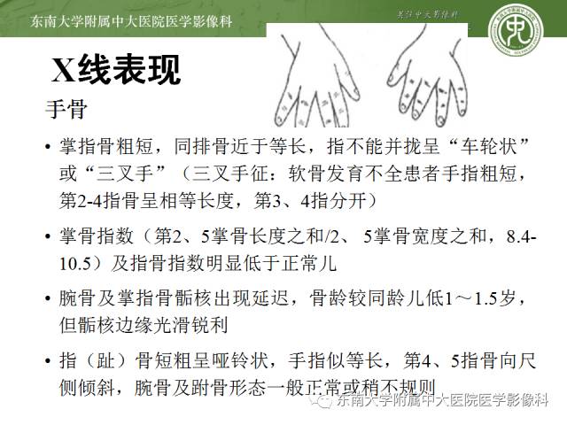 【病例】软骨发育不全1例X线影像表现