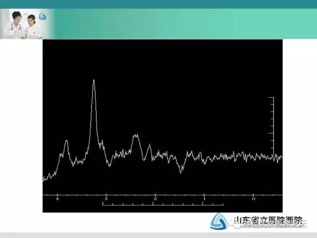 【病例】典型嗅沟脑膜瘤1例MR影像讨论