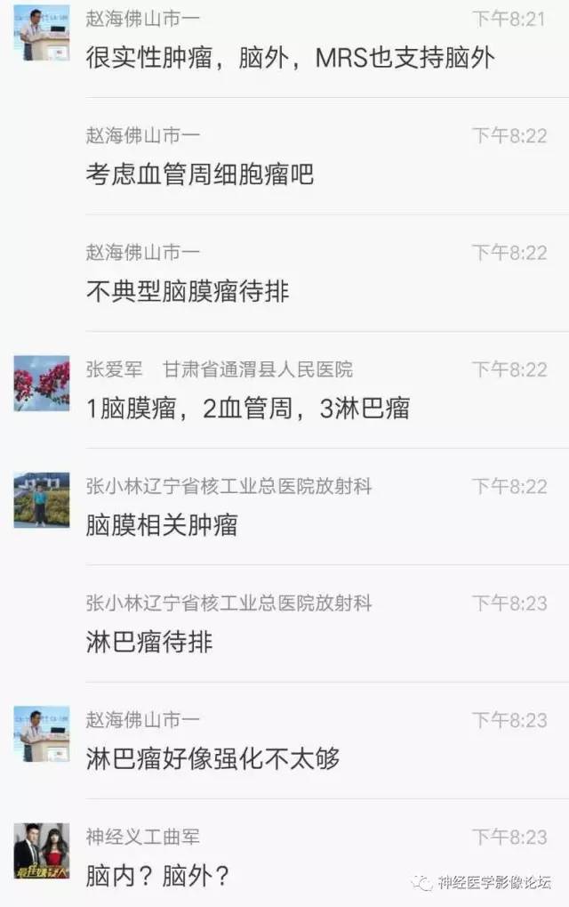 【病例】典型嗅沟脑膜瘤1例MR影像讨论