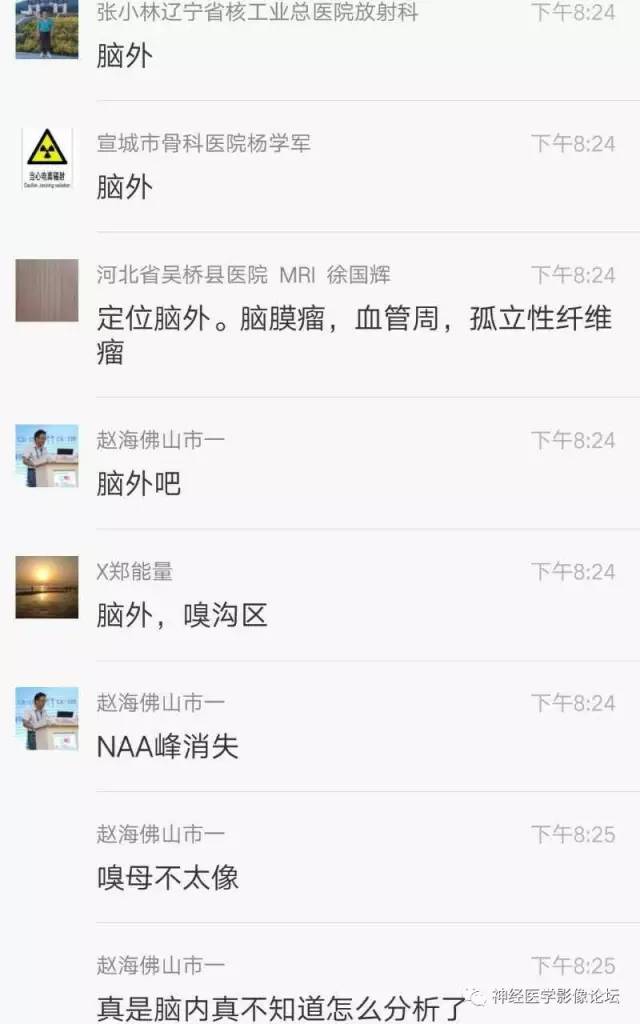 【病例】典型嗅沟脑膜瘤1例MR影像讨论