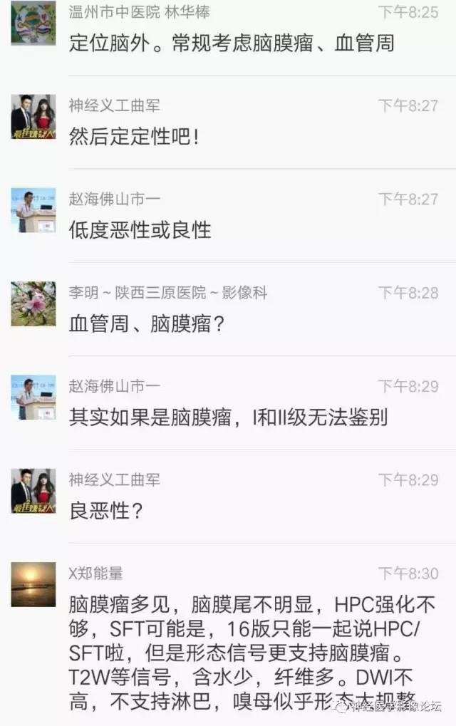 【病例】典型嗅沟脑膜瘤1例MR影像讨论