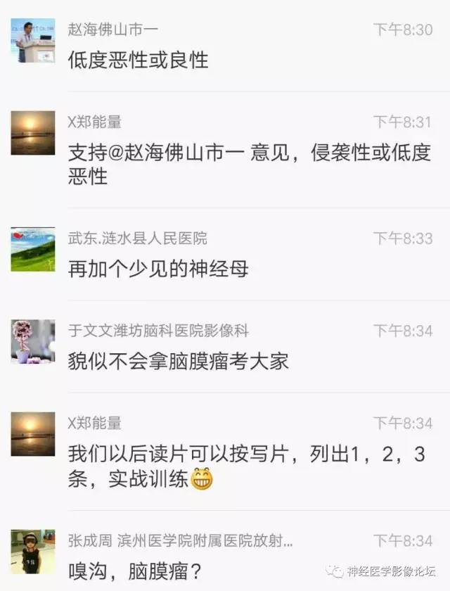 【病例】典型嗅沟脑膜瘤1例MR影像讨论