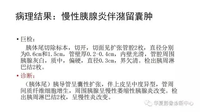 【病例】慢性胰腺炎伴潴留囊肿1例CT