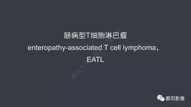 【病例】小肠肠病型T细胞淋巴瘤1例CT影像诊断