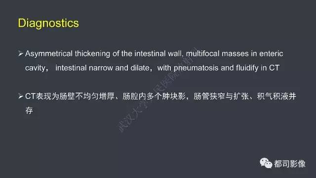 【病例】小肠肠病型T细胞淋巴瘤1例CT影像诊断