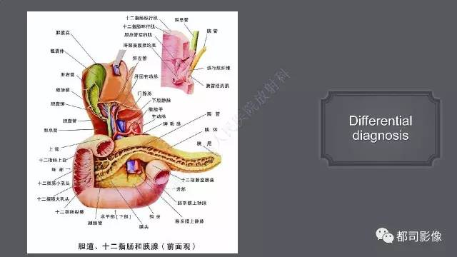 【病例】小肠肠病型T细胞淋巴瘤1例CT影像诊断