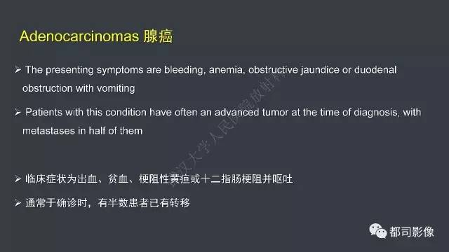 【病例】小肠肠病型T细胞淋巴瘤1例CT影像诊断