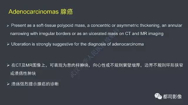 【病例】小肠肠病型T细胞淋巴瘤1例CT影像诊断