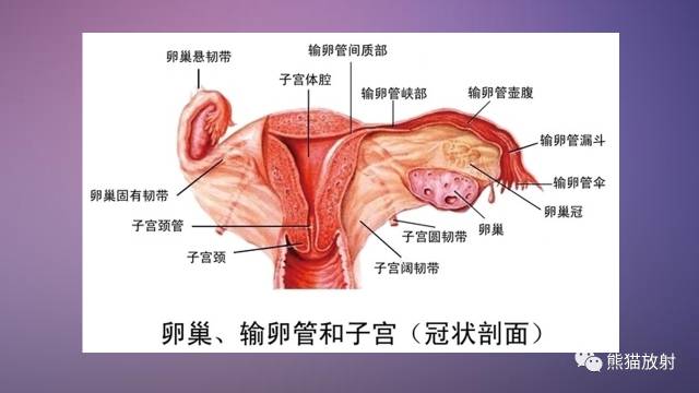 【PPT】女性盆腔肿瘤的MRI诊断