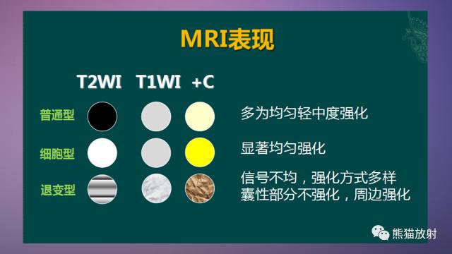 【PPT】女性盆腔肿瘤的MRI诊断