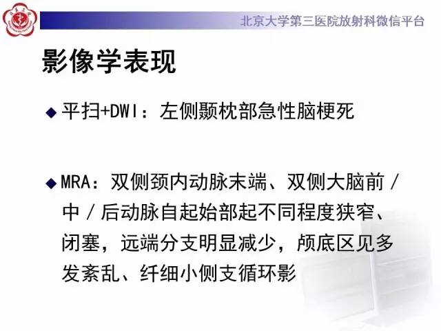 【病例】烟雾病2例影像表现