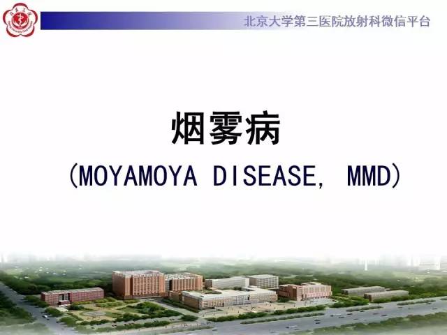 【病例】烟雾病2例影像表现
