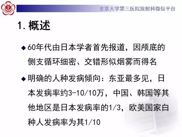 【病例】烟雾病2例影像表现