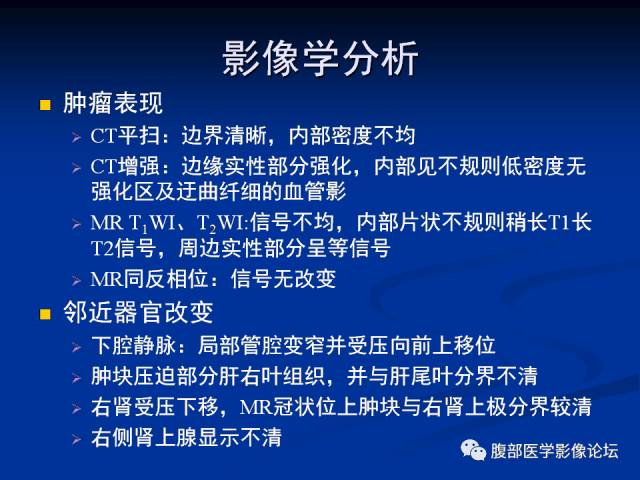 【病例】腹膜后胚胎性横纹肌肉瘤1例CT