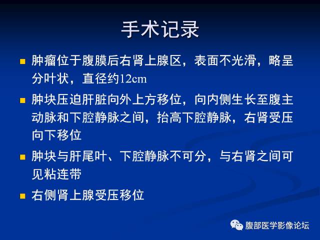 【病例】腹膜后胚胎性横纹肌肉瘤1例CT