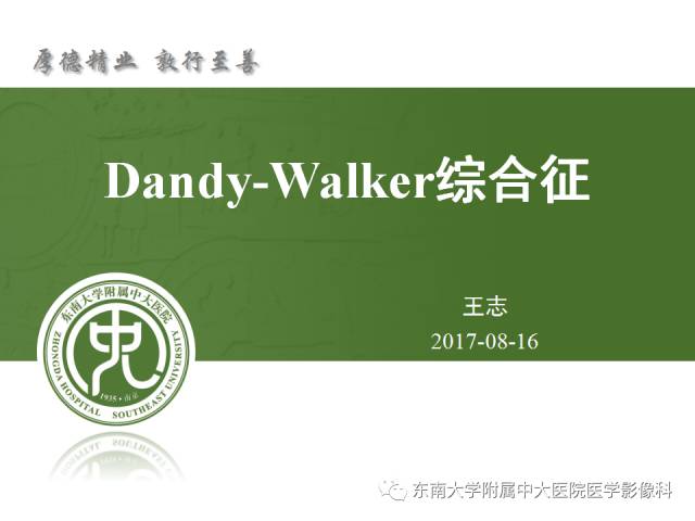 【病例】Dandy-Walker综合征1例MR