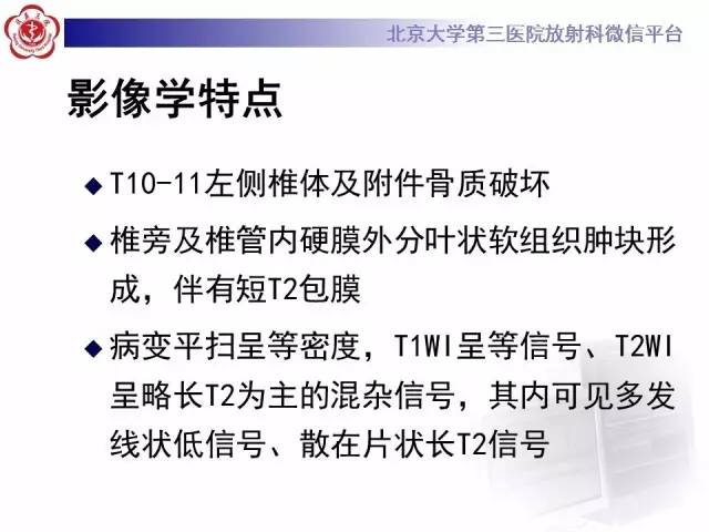 【病例】胸椎孤立性纤维瘤1例CT及MR