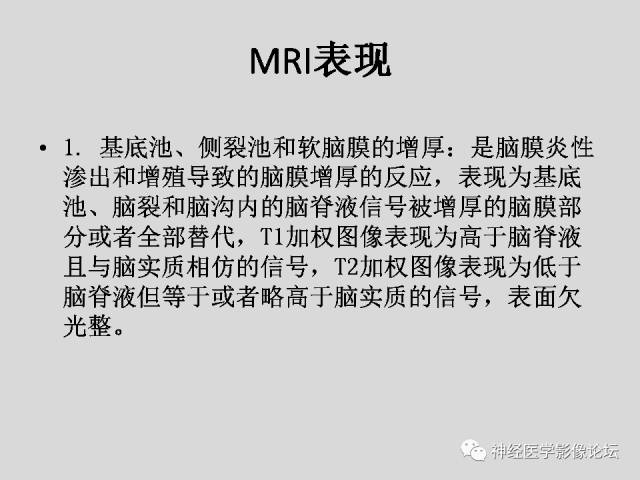【PPT】颅内结核