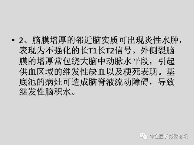 【PPT】颅内结核