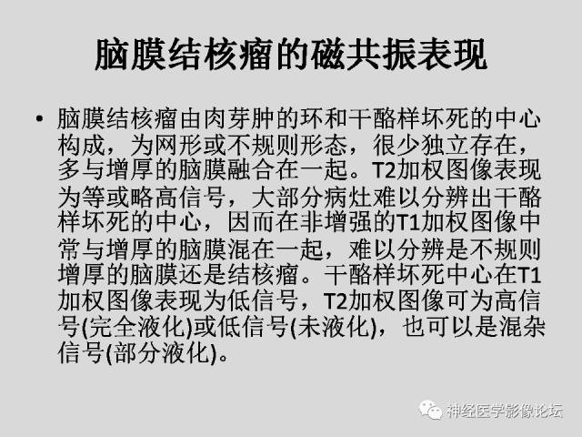 【PPT】颅内结核