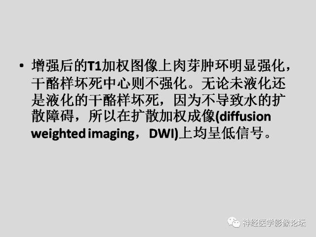 【PPT】颅内结核